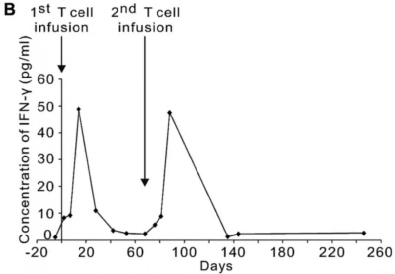 NY-ESO-1 TCRT疗法治疗非小细胞肺癌的数据
