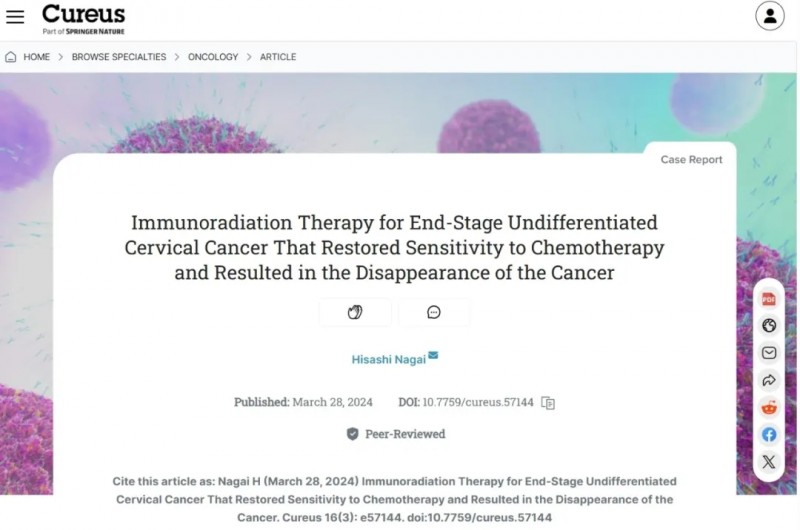 Cureus杂志报道DC疫苗治疗宫颈癌