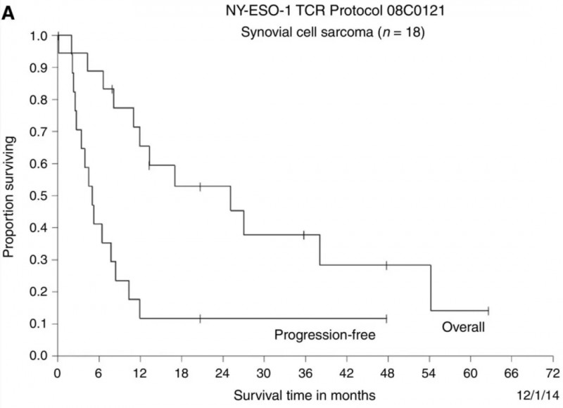 NY-ESO-1 TCR-T疗法治疗滑膜肉瘤的数据