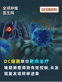 DC细胞联合靶向治疗，晚期肺癌得到有效控制，未发现复发或转移迹象 #DC细胞 #靶向治疗 #肺癌