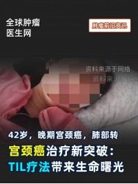 宫颈癌治疗新突破：TIL疗法带来生命曙光 #宫颈癌 #TIL疗法