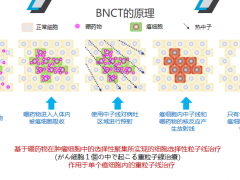 日本硼中子俘获疗法(BNCT)，治疗时间30～60分钟，精准“爆破”癌细胞