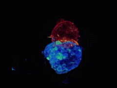 免疫治疗肿瘤效果好吗？2万+患者印证，主动出击才是王道，早期免疫疗法联合重塑多癌种预后