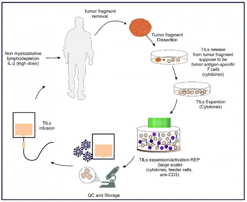 TIL疗法的实施流程示意图