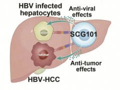 TCR-T细胞疗法SCG101治疗乙肝相关肝癌控病率高达66.7%