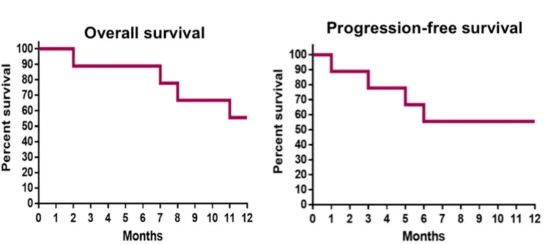 NK细胞疗法治疗儿童胶质瘤的生存数据