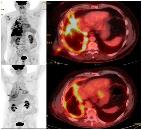 英国医疗保健杂志