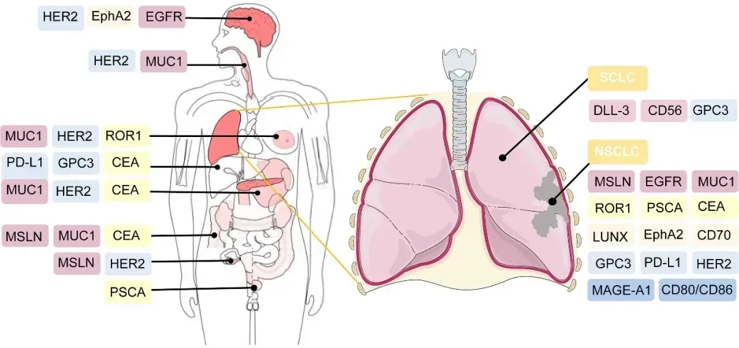 GPRC5D CART细胞疗法治疗多发性骨髓瘤的数据