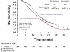 2026年胰腺癌新技术新疗法治疗方案