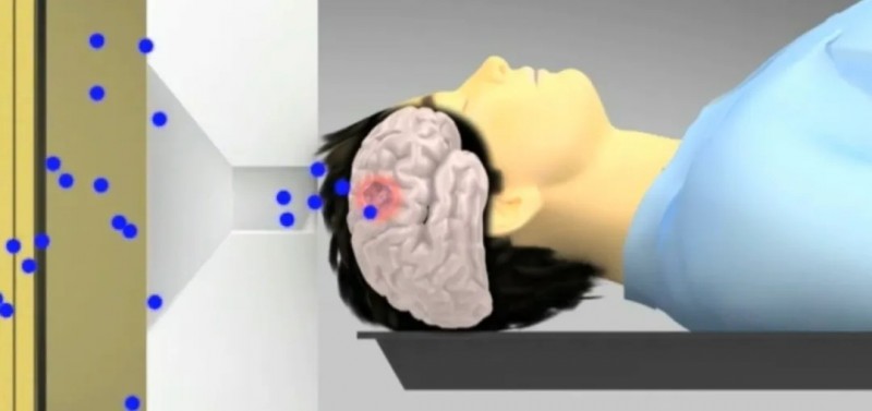 硼中子俘获疗法