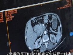 多类晚期癌症患者“奇迹”缓解！国研TIL细胞疗法开启自身免疫杀伤癌细胞的抗癌新时代