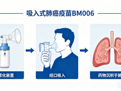 肺癌疫苗重大突破，晚期患者多了一个新的选择